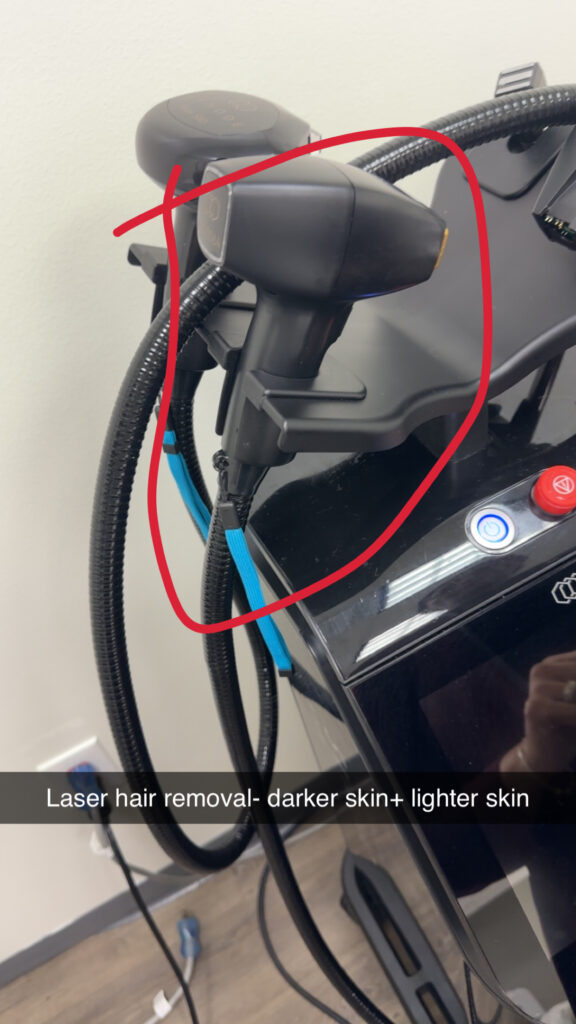Laser hair removal with Diolaze XL in Frisco, TX for smooth, irritation-free skin