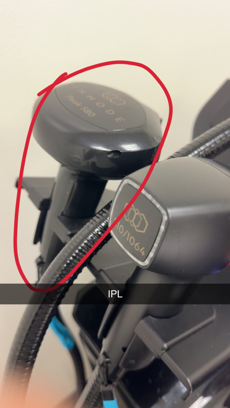 Lumecca Peak 580 IPL device used for photofacials in Frisco, TX medspa